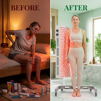 Red Light Therapy Device with Stand - Moving Pro Series Professional Edition — Before & After
